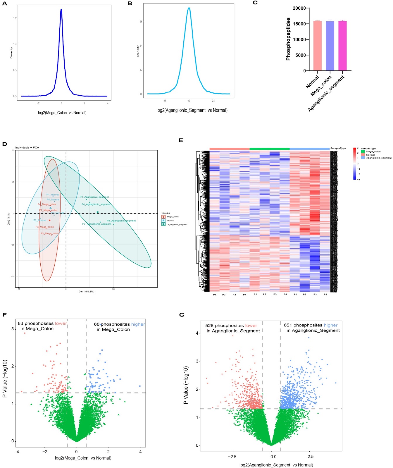 Integrated quantitative proteomics and phosphoproteomics analysis reveals USP46-POU4F1-HPSE signaling axis in the pathogenesis of Hirschsprung disease