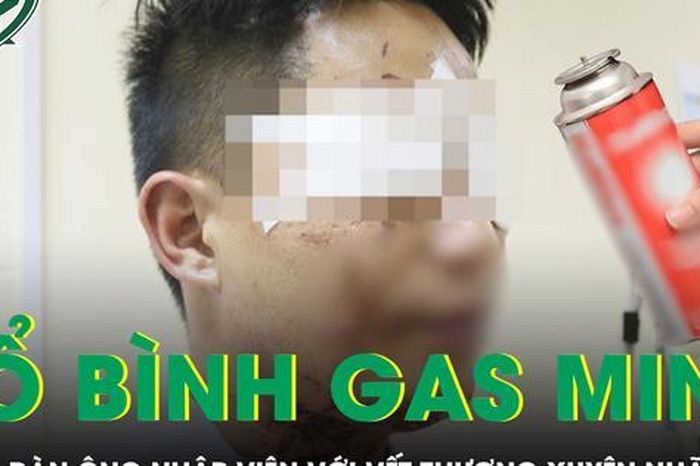 Người đàn ông nhập viện với vết thương xuyên nhãn cầu do bình gas mini phát nổ - Báo Sức Khỏe &amp; Đời Sống