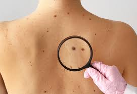 Tecidos Moles