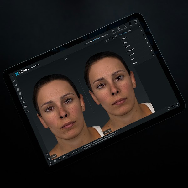 Tablette affichant l’interface de l’application Crisalix avec une simulation de visage 3D.