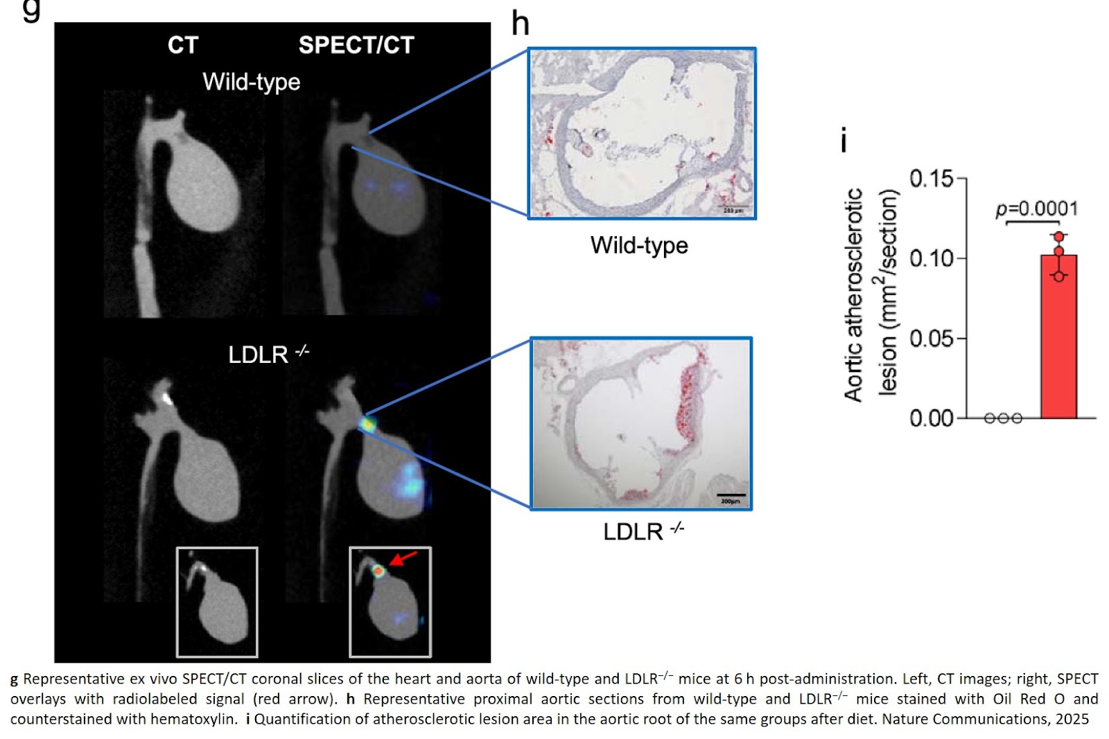 Sources of essential lipids for Mycoplasma pneumoniae via P116 to target liver and atherosclerotic lesions