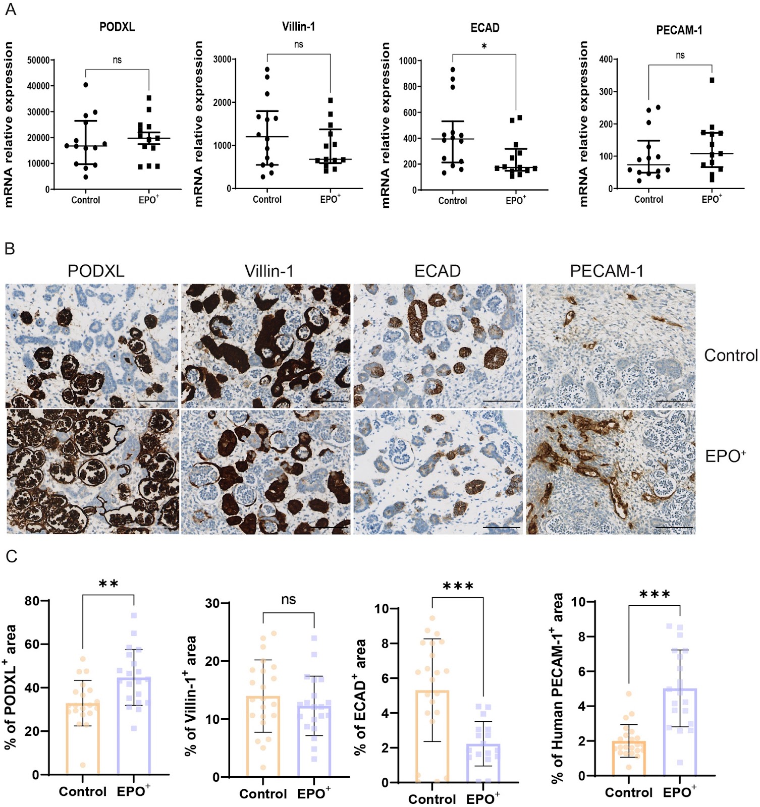 Erythropoietin delivery through kidney organoids engineered with an episomal DNA vector