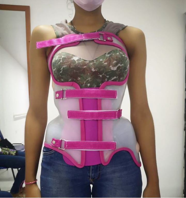 Corset TLSO - CORSETS