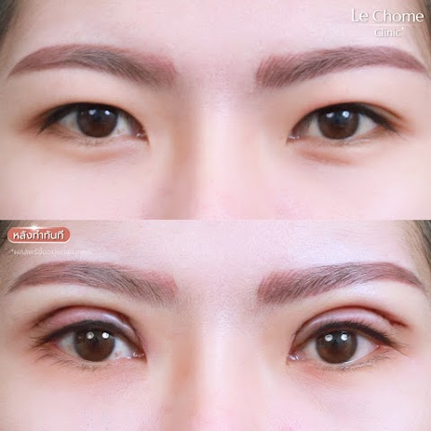 ตา 2 ชั้น