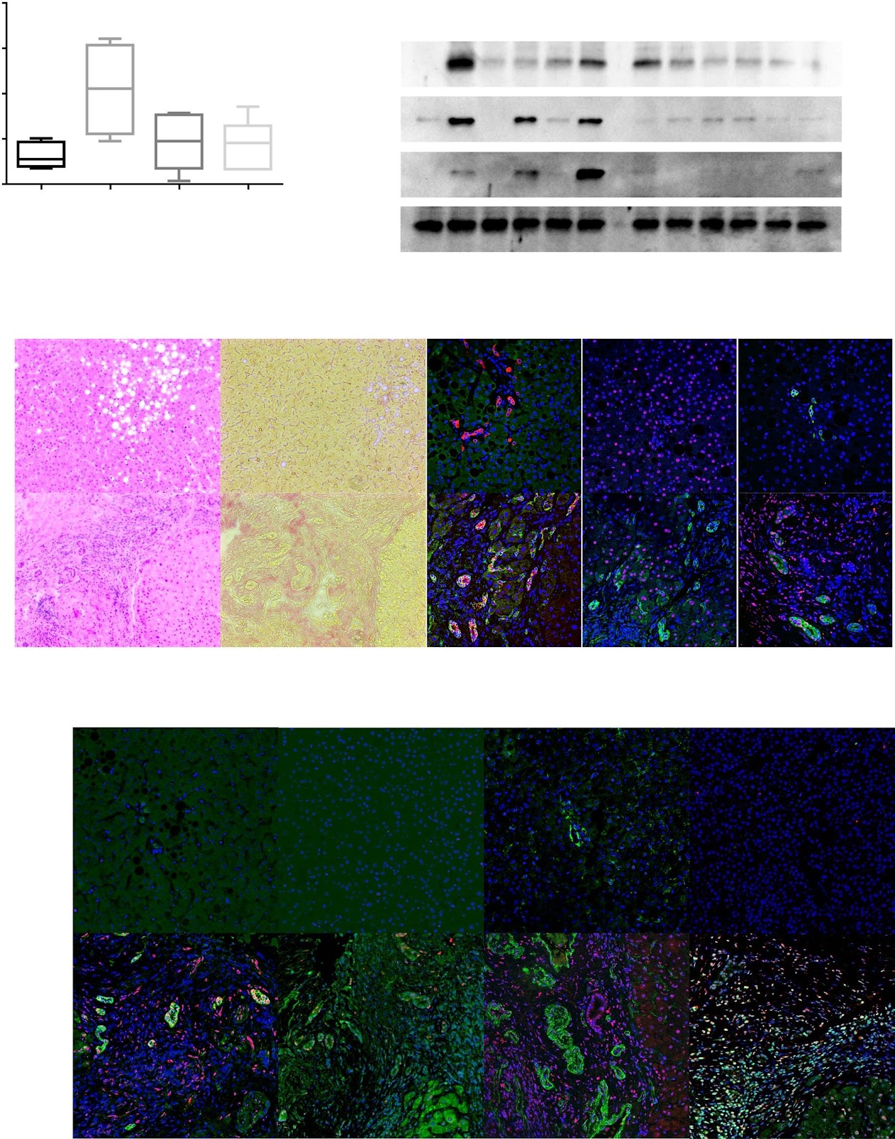 Targeting NPM1 inhibits proliferation and promotes apoptosis of hepatic progenitor cells via suppression of mTOR signalling pathway