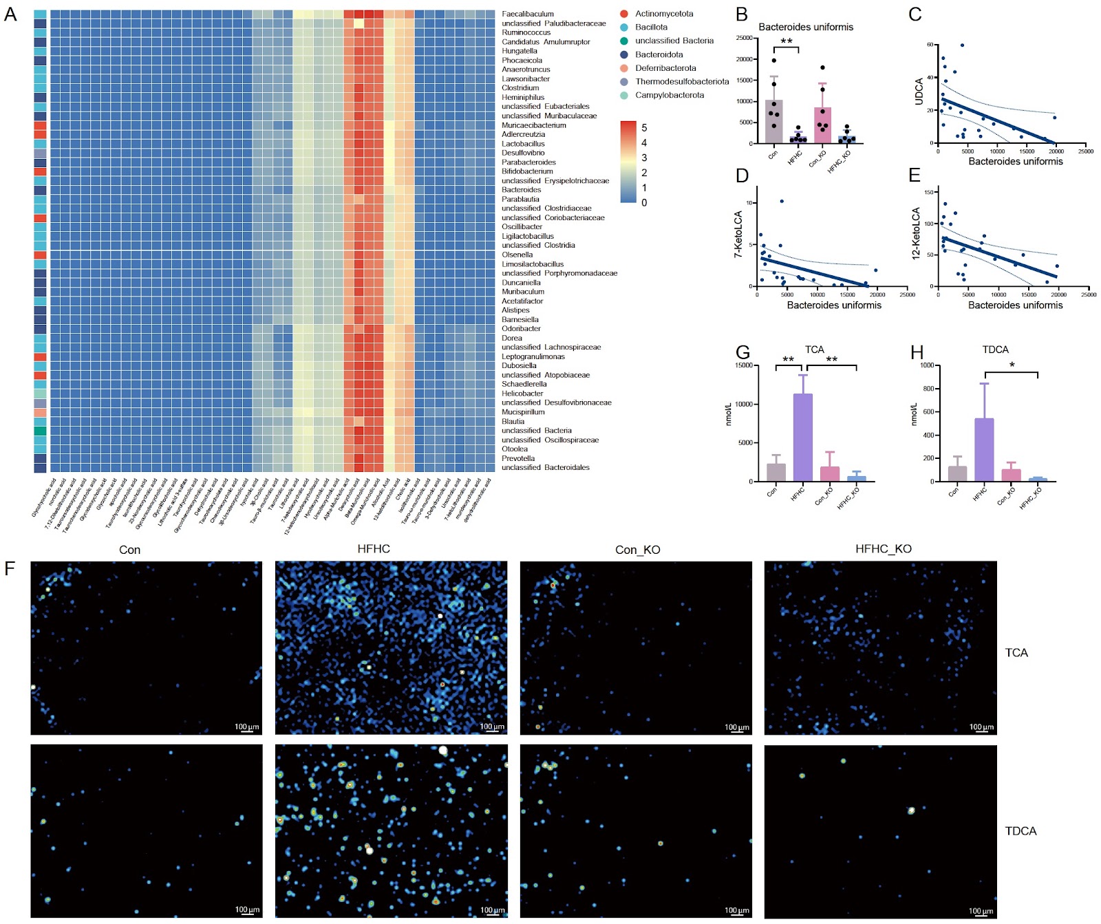 Gut microbiota and bile acids changes in MASLD mice model with hepatic PLD1 knockout