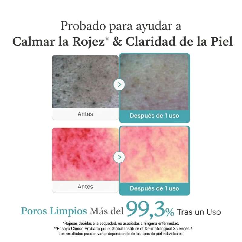 Niacinamida al 99% de pureza y glicerina hidratante