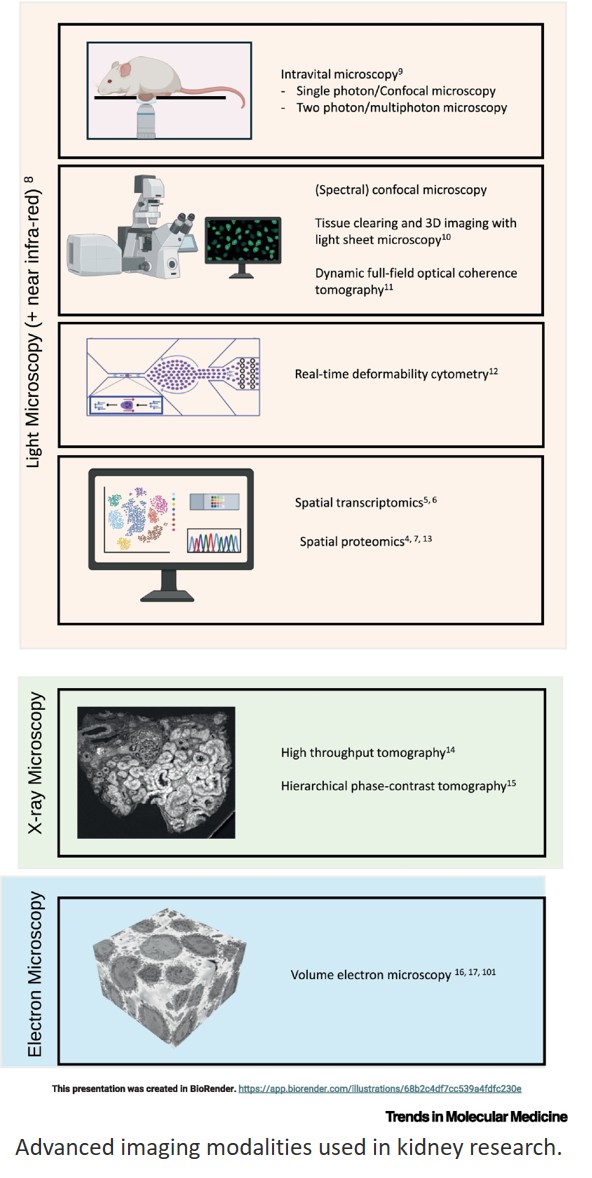 Advanced imaging of immune cells for human kidney disease