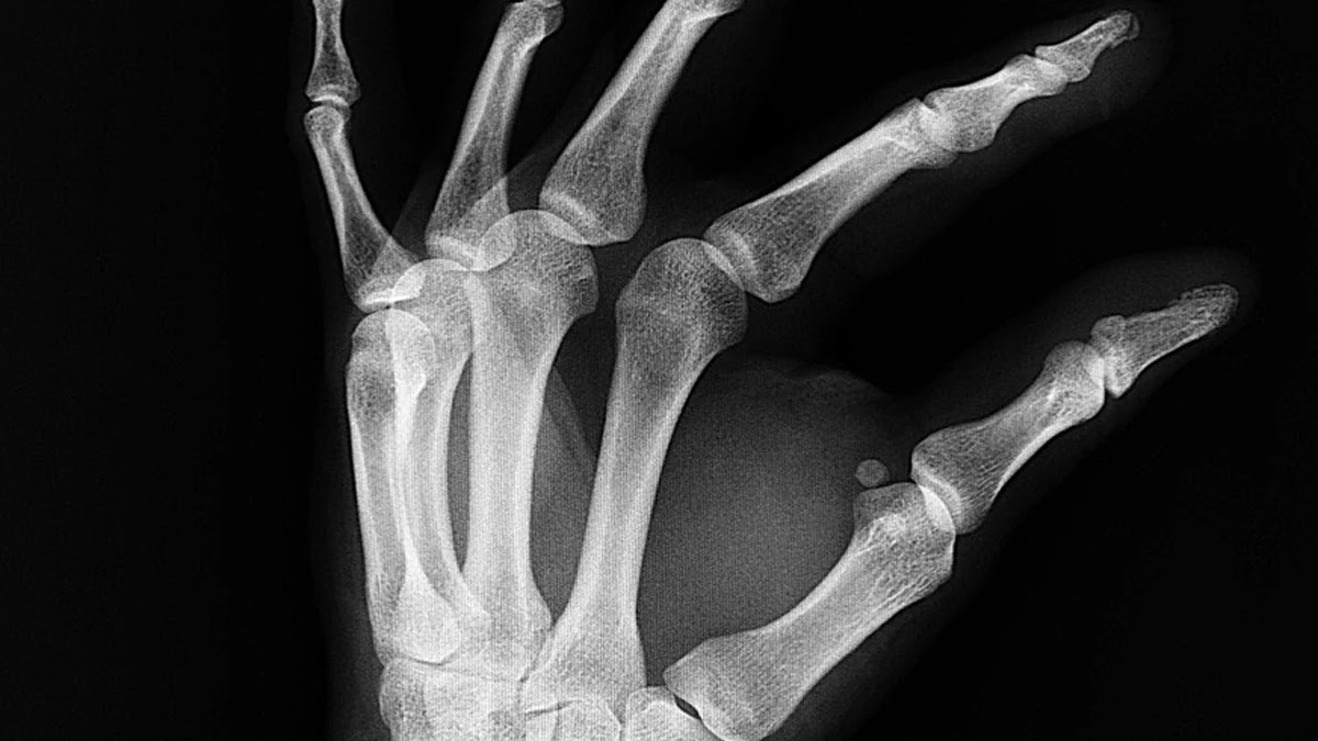 암보험 진단비 보장 범위별 비교와 맞춤형 선택 기준