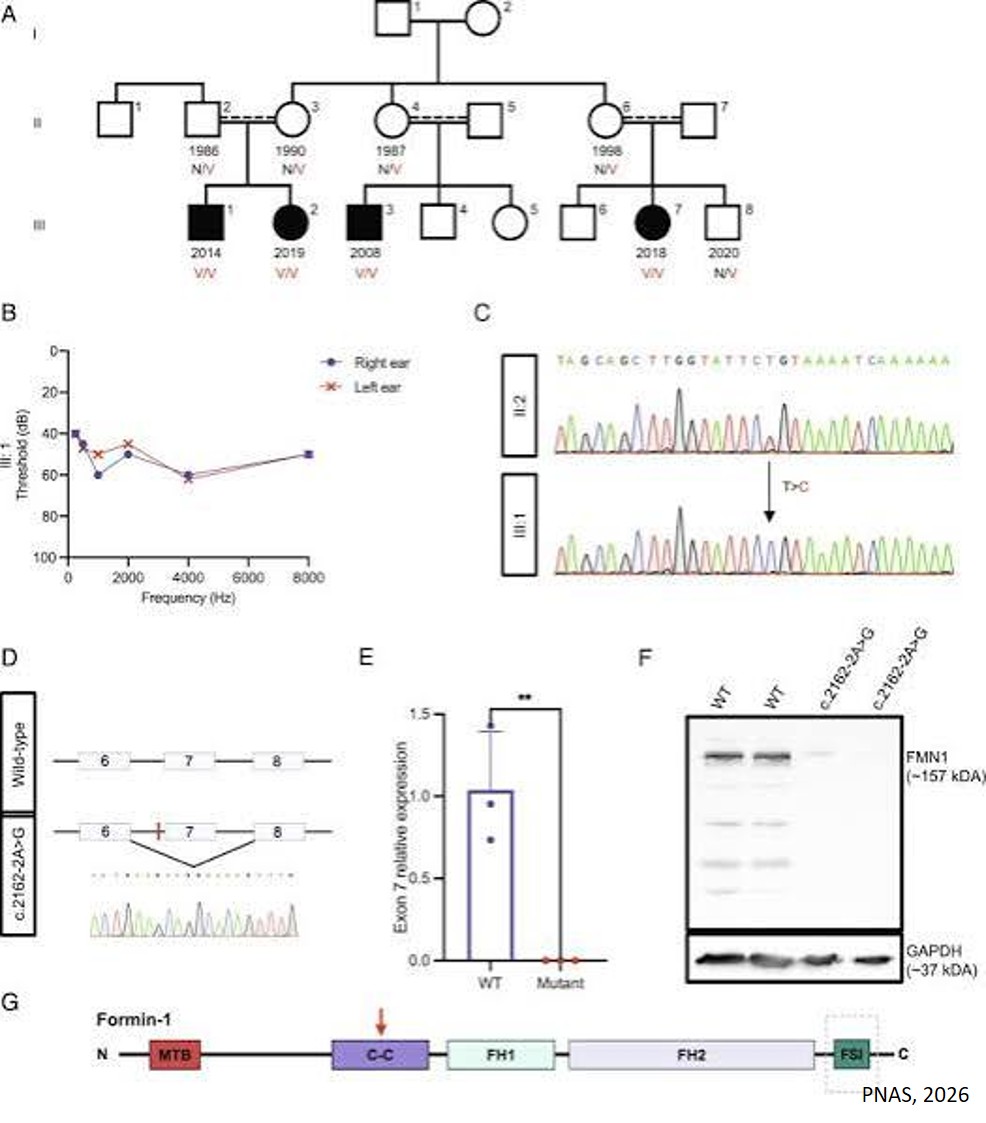 New genetic mechanism essential for hearing identified!