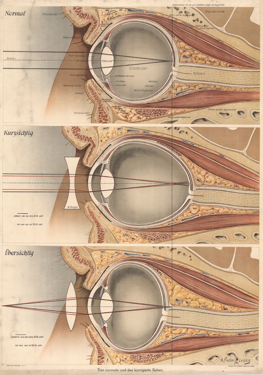 The eye 1916