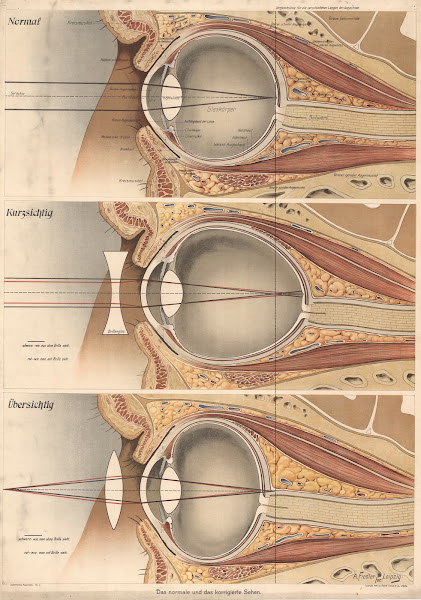 The eye 1916