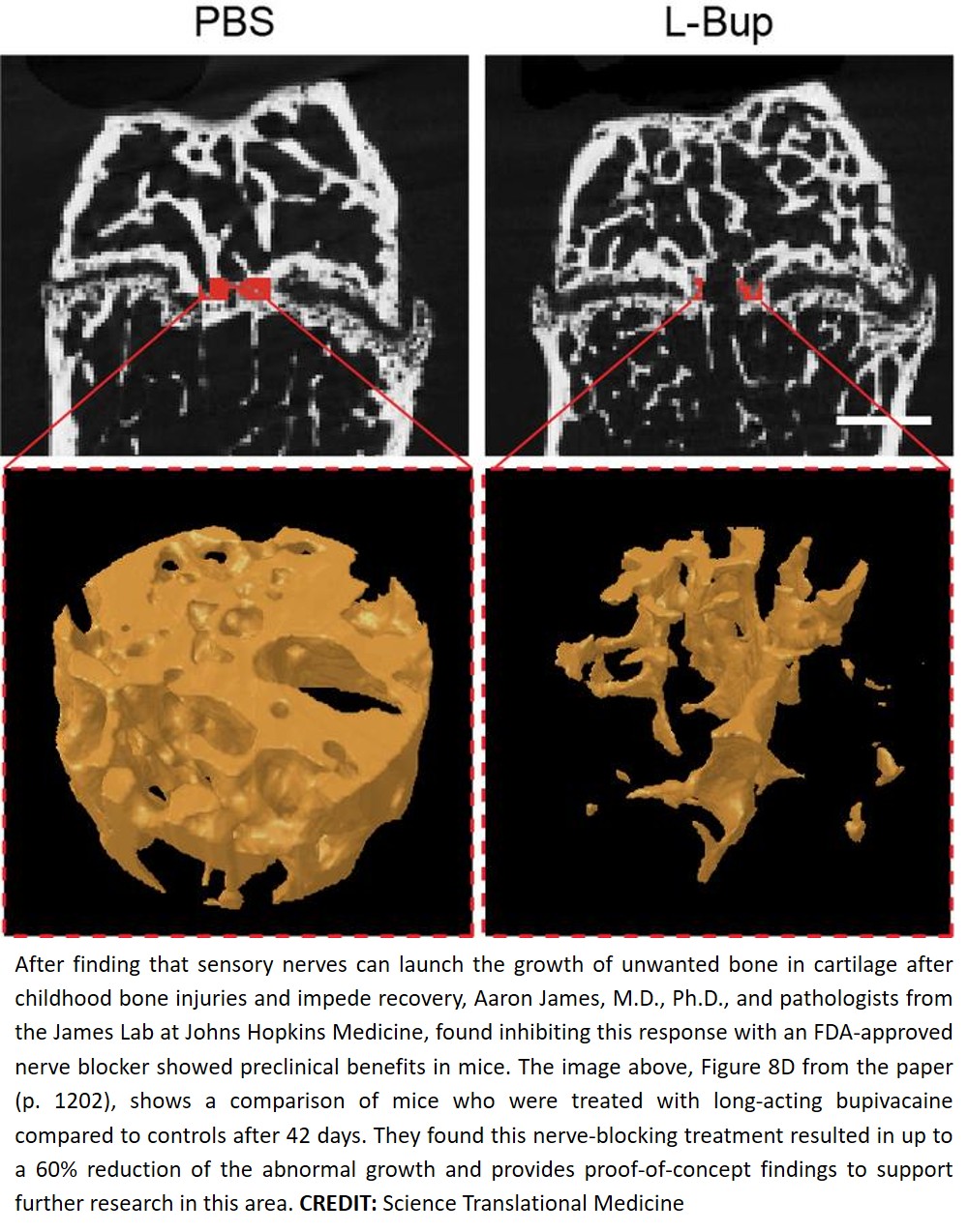 Targeting sensory nerves after growth plate injuries may bolster healing
