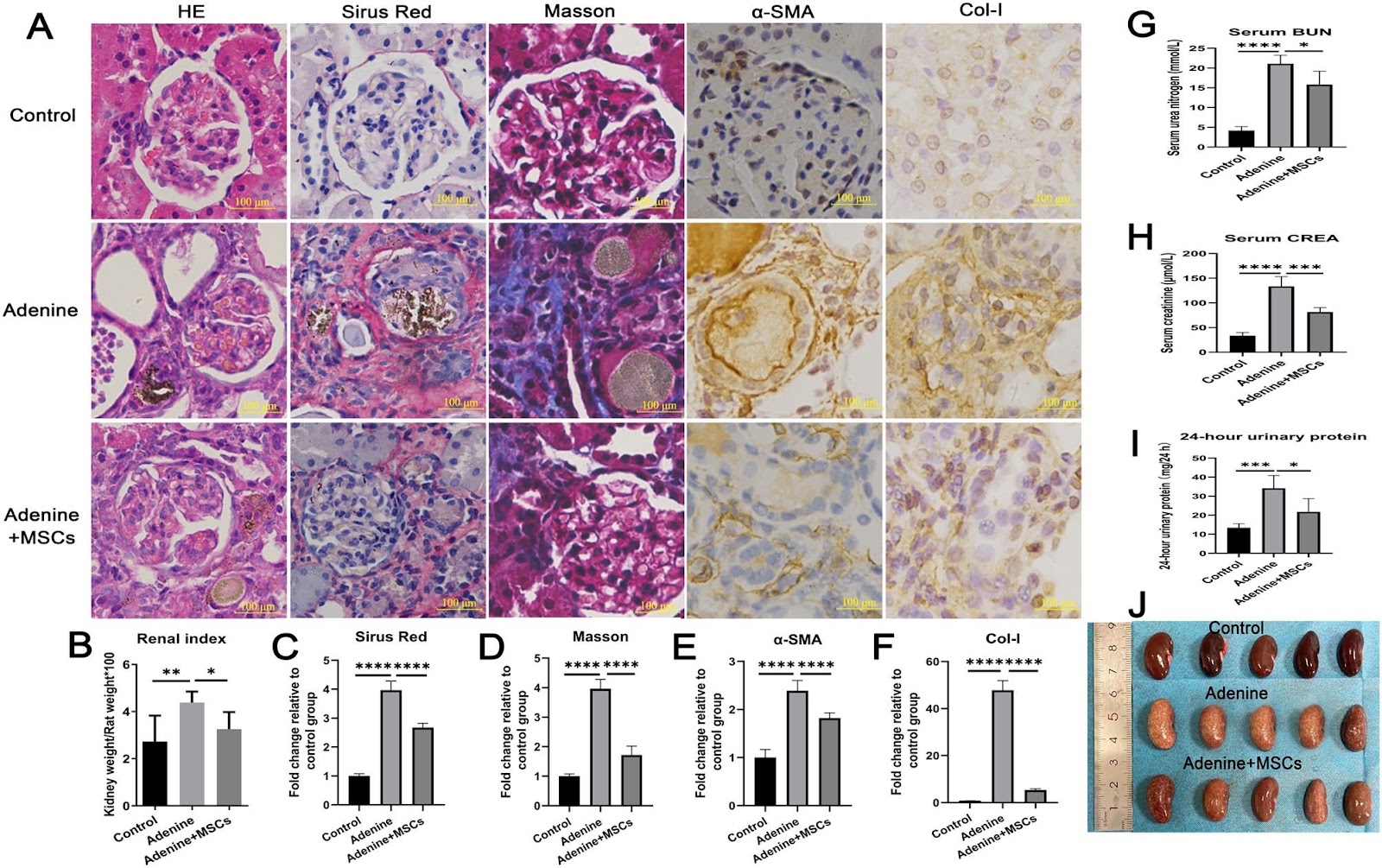 Mesenchymal stem cells inhibit mitochondrial fission by upregulating armadillo repeat containing 1, ameliorating oxidative stress in renal fibrosis