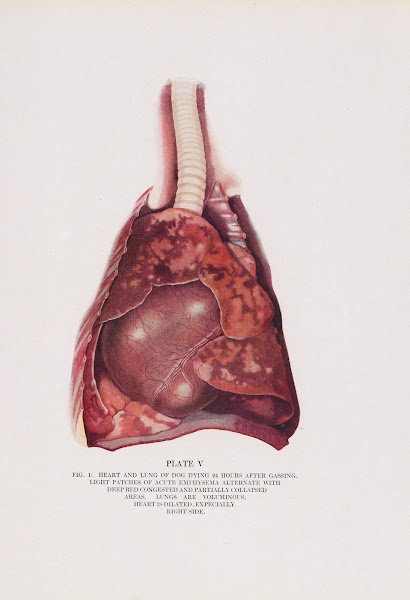 Plate V Fig 1 Heart and lung of dog dying 24 hours after gassing 1920