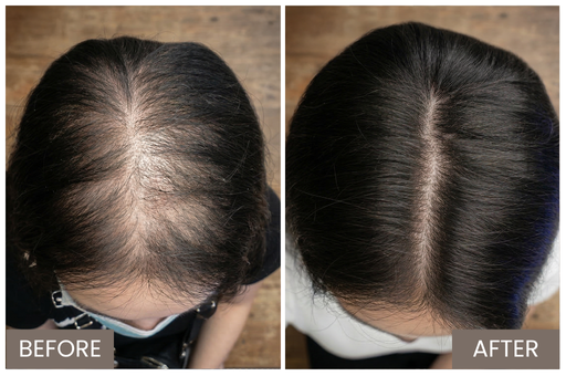 Ha'Labo Result