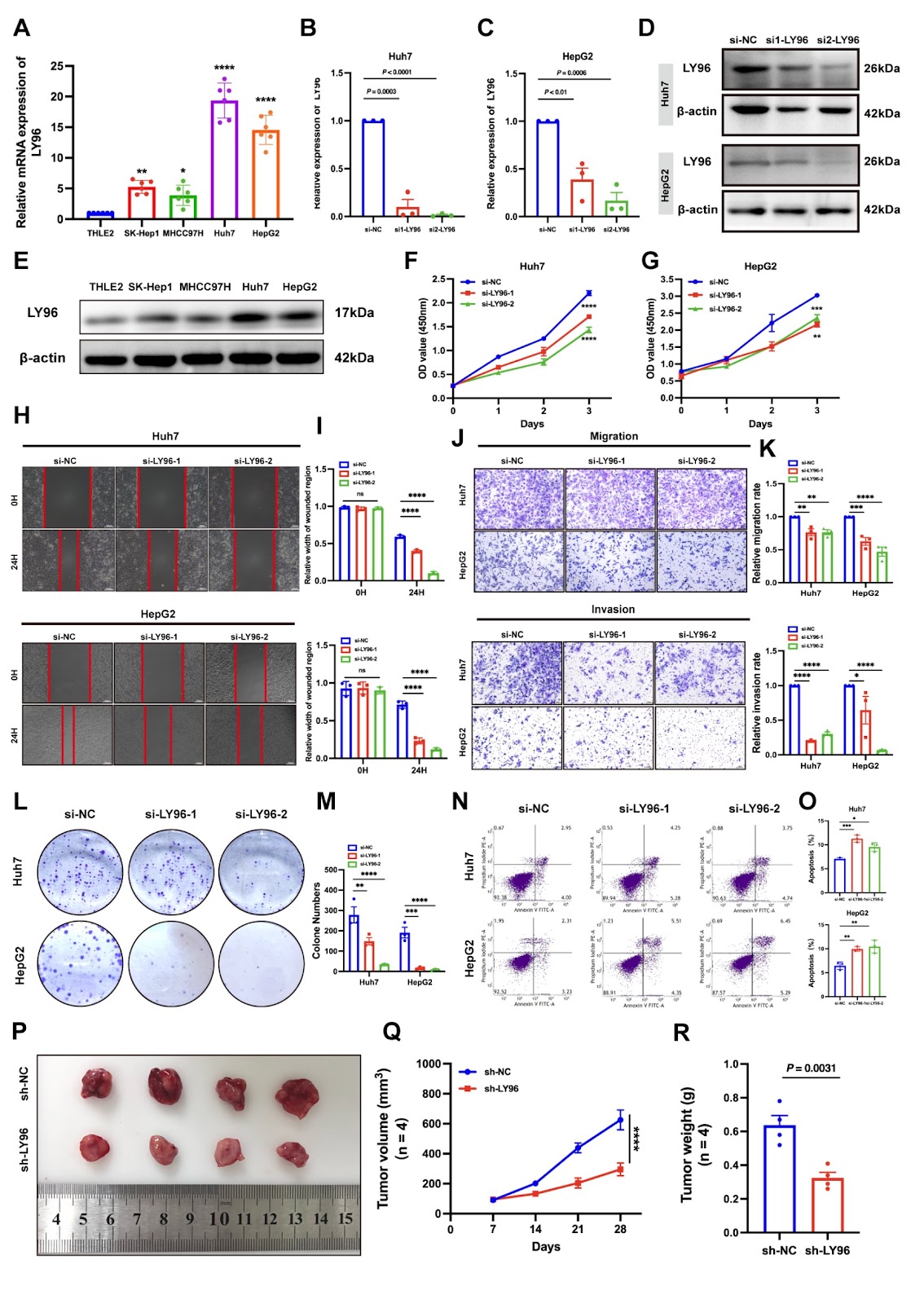 Ly96-mediated activation of TGF-β1/Smad2/3 signaling in hepatocellular carcinoma and its potential for nanoparticle-based therapy