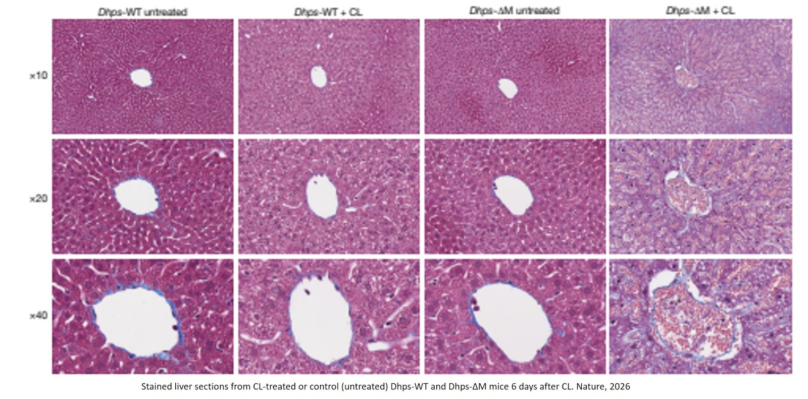 Enzyme required for transition from monocyte to tissue-resident macrophage identified!