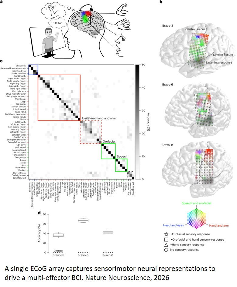 Simultaneous speech and gesture decoding for multimodal communication in paralysis