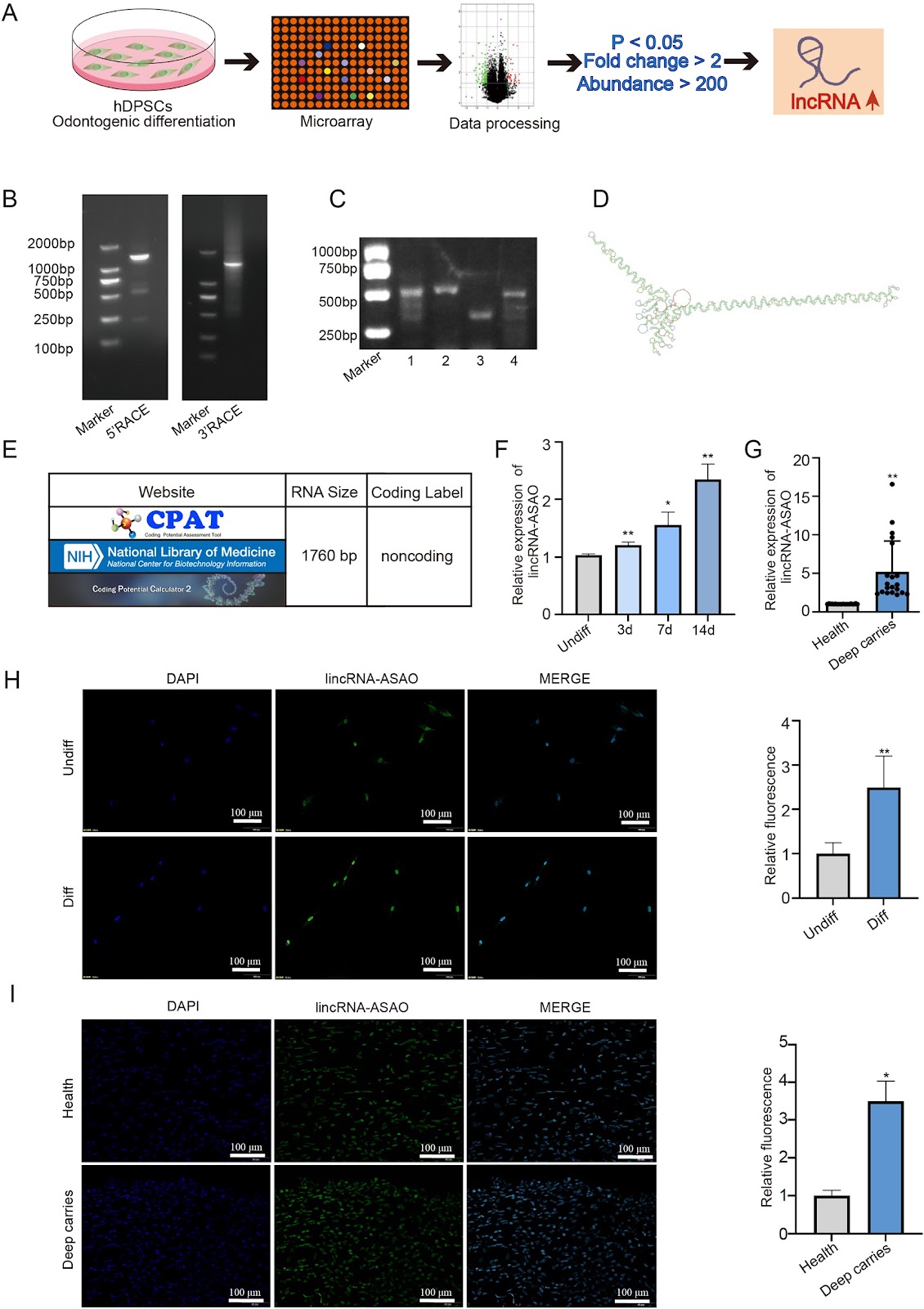 LincRNA-ASAO promotes dental pulp repair through interacting with PTBP1 to increase ALPL alternative splicing