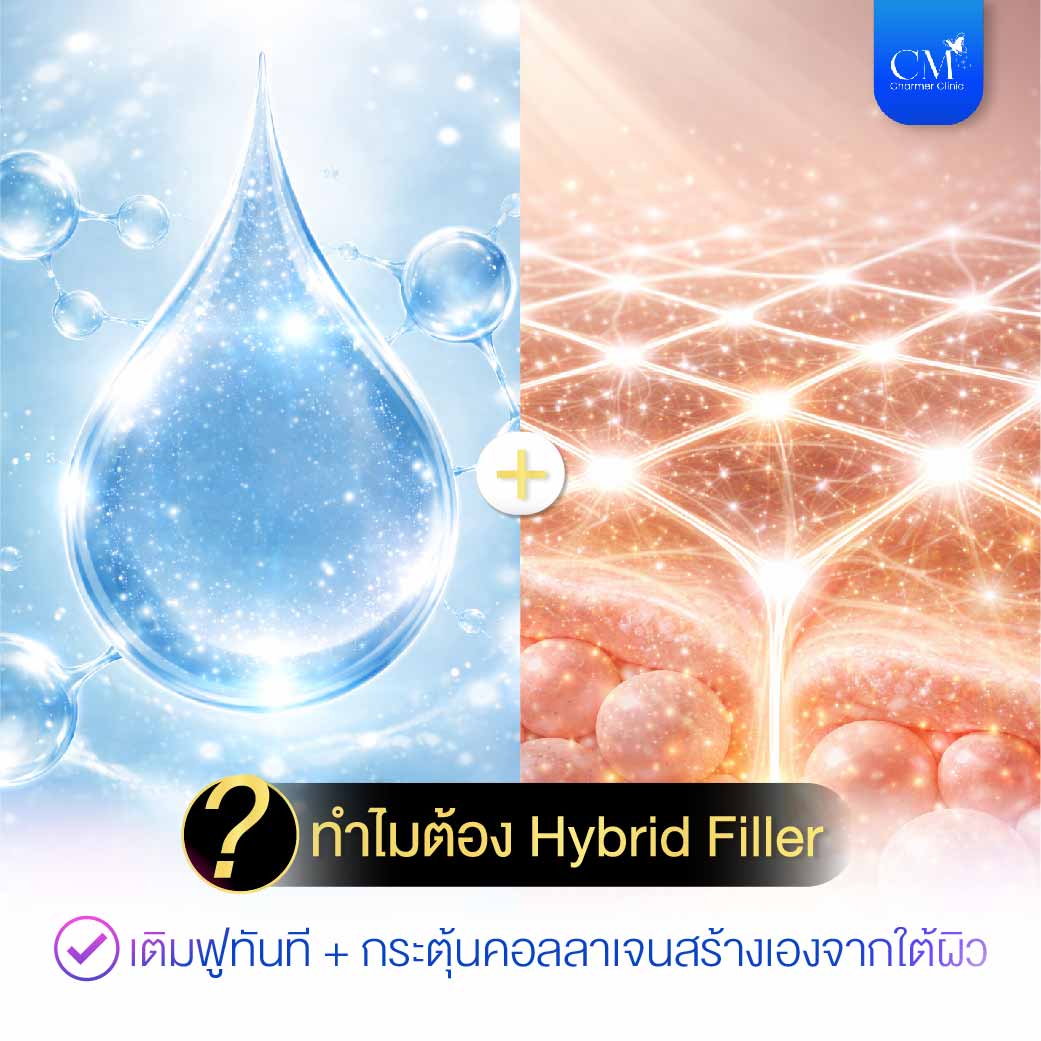 Juvelook Volume กลไกการทำงาน Hybrid Filler