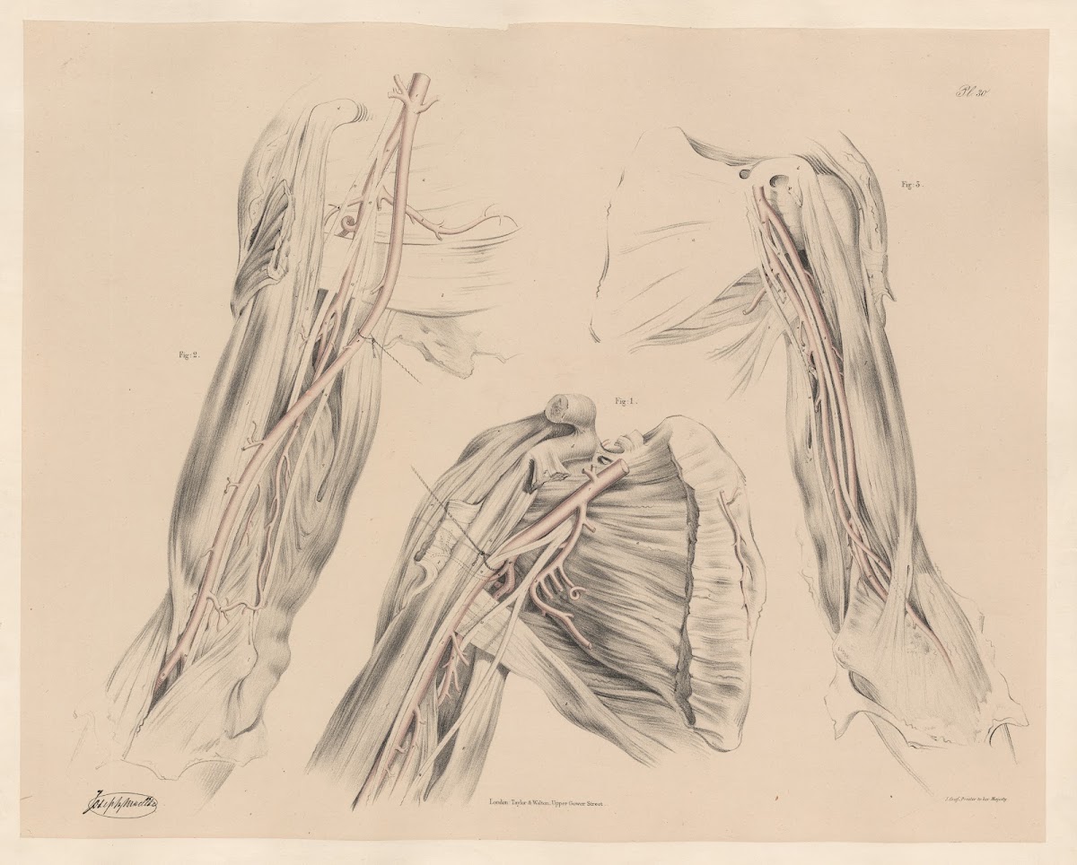 Peculiarities of the Axillary artery and of its branches 1844