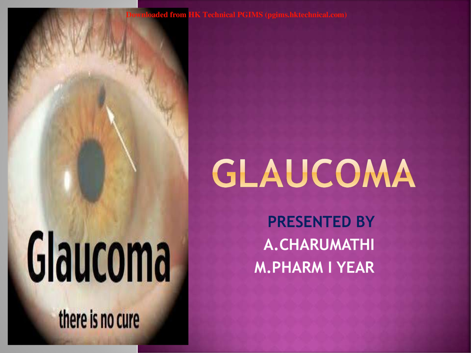 Glaucoma PPT 1st Semester M.Pharmacy Lecture Notes,Pharmacotherapeutics-I,