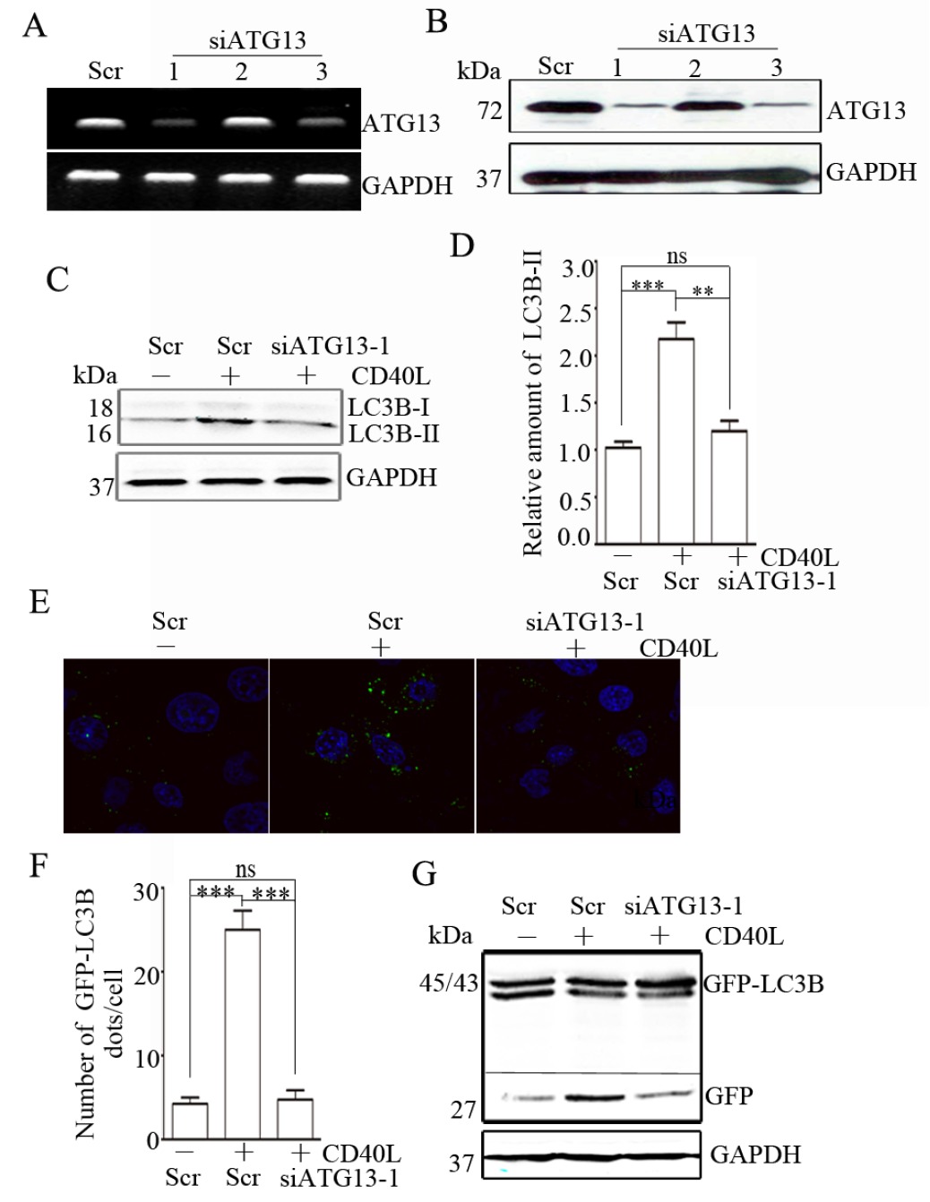CD40 ligation-induced ERK activation leads to enhanced radiosensitivity in cervical carcinoma cells via promoting autophagy