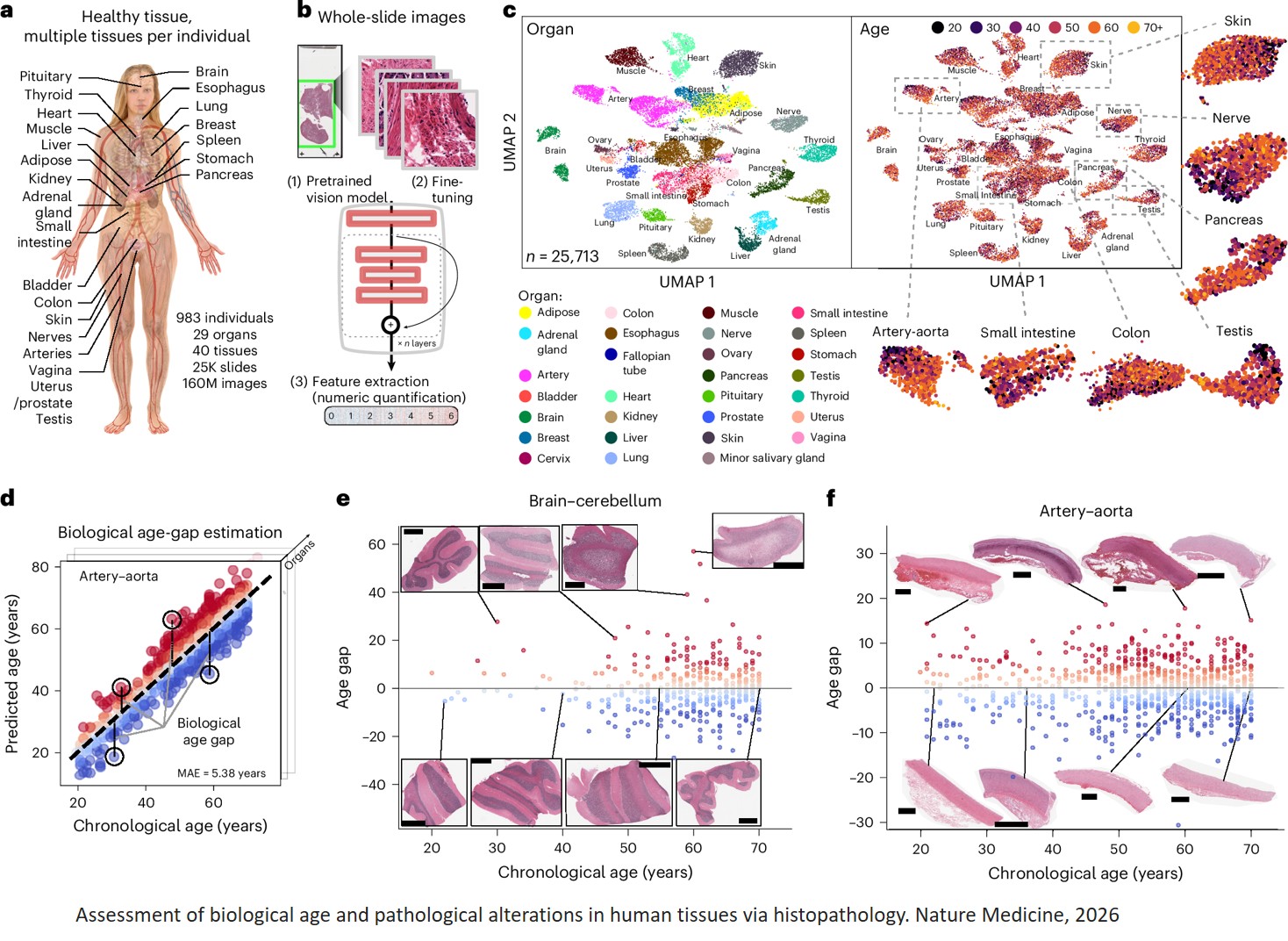 Histological aging signatures for monitoring tissue-specific aging and disease