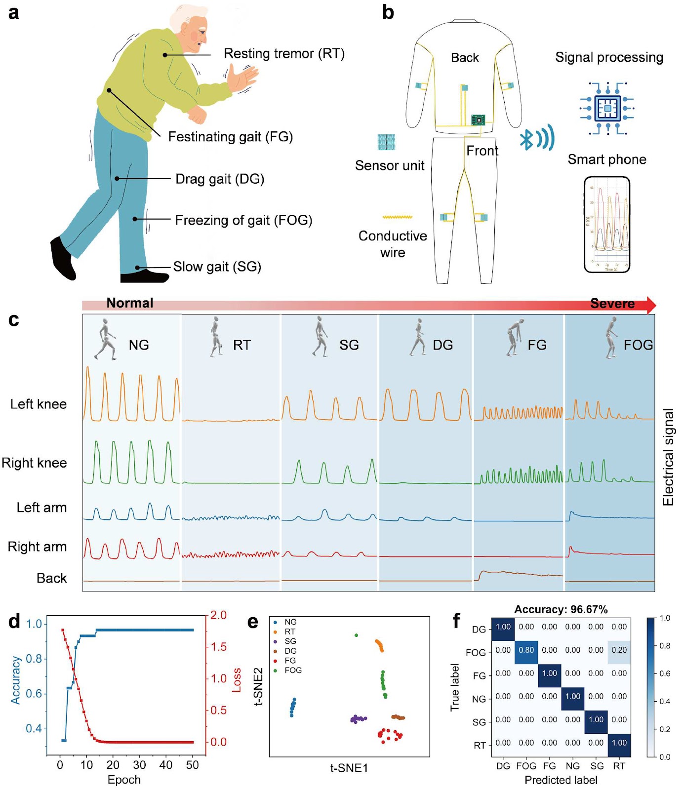 Interlocking integration of elastic strain sensor yarn enables smart and distributed sensing in healthcare clothing