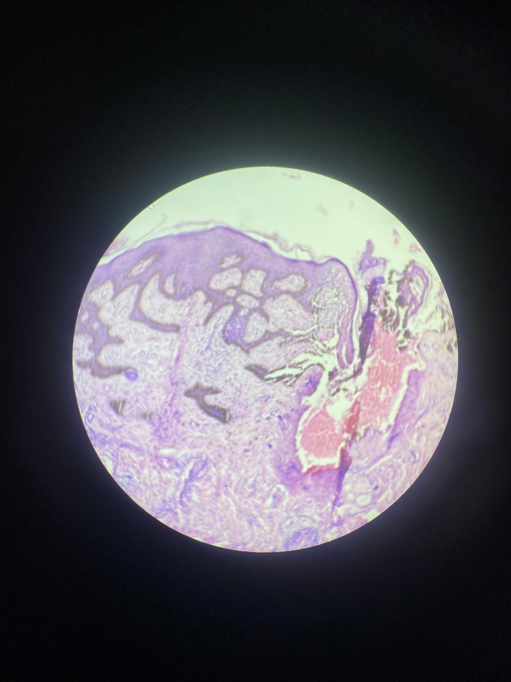 Microscopy Analysis