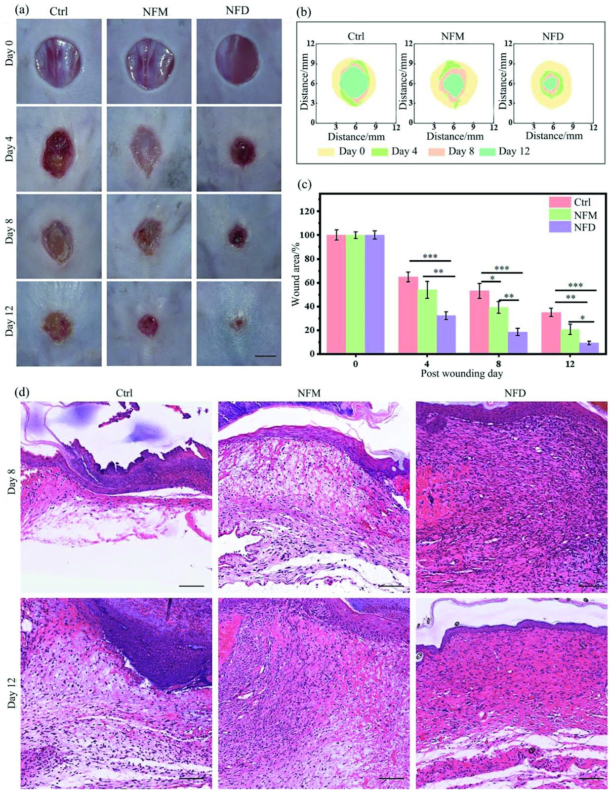 Porous nanofibrous dressing enables mesenchymal stem cell spheroid formation and delivery to promote diabetic wound healing