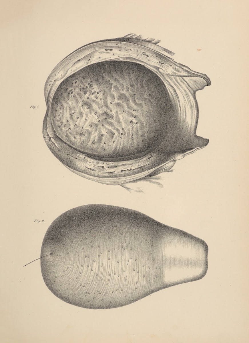 Uterus of an Adult Woman who Died forty four hours after Delivery intended to sh
