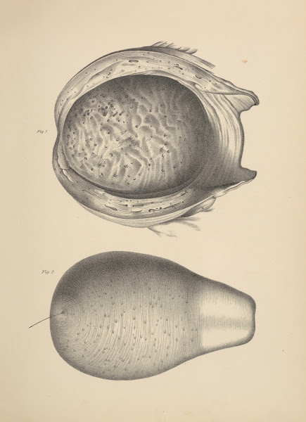 Uterus of an Adult Woman who Died forty four hours after Delivery intended to sh