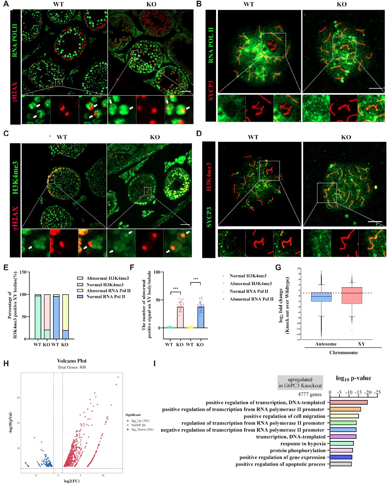 G6PC3 is involved in spermatogenesis by maintaining meiotic sex chromosome inactivation