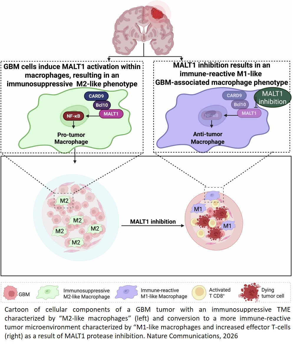 MALT1 protease inhibition restrains glioblastoma progression by reversing tumor-associated macrophage-dependent immunosuppression in mice
