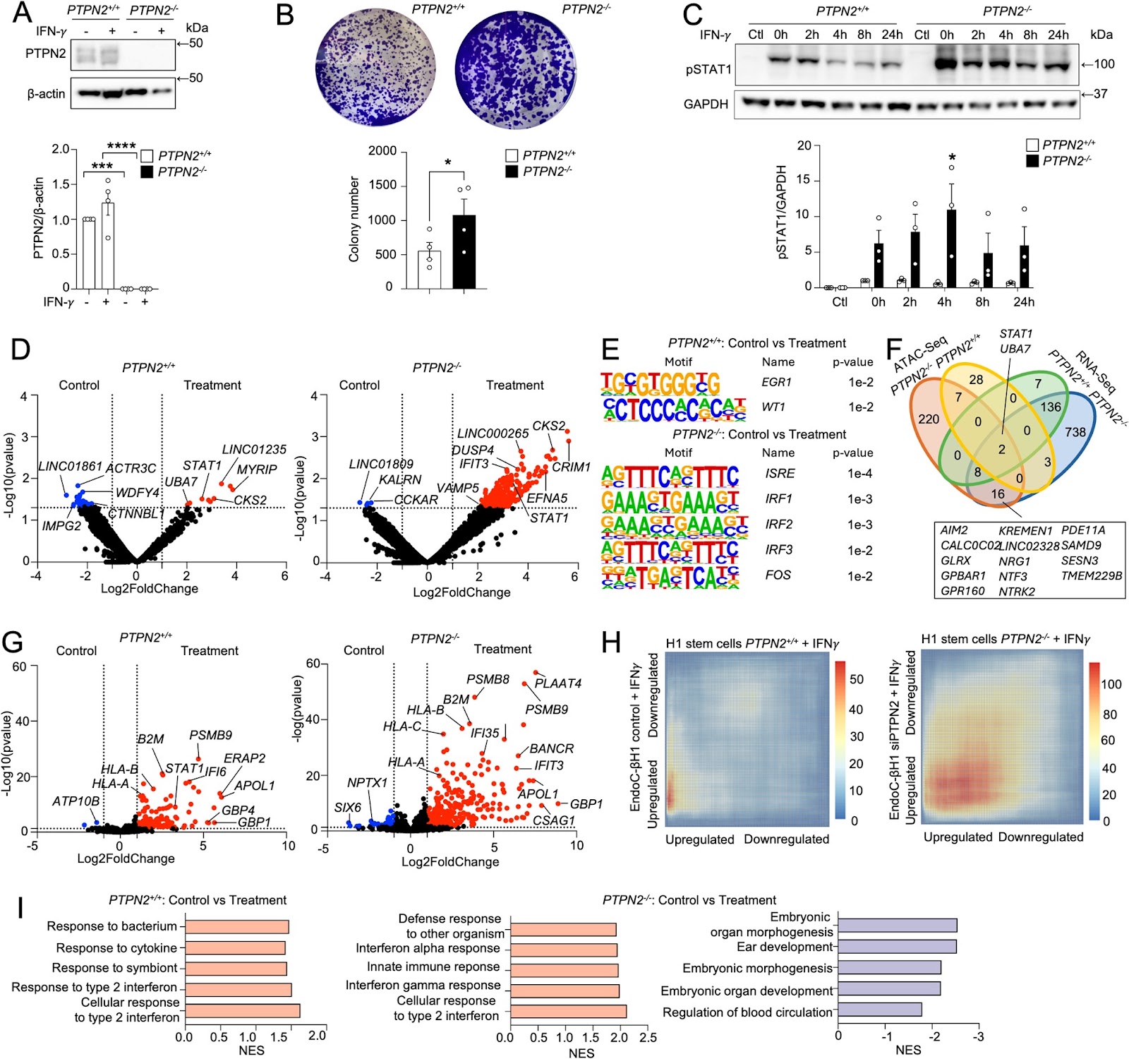 PTPN2 deficiency amplifies inflammatory signalling and impairs functional maturation of human stem cell-derived islets
