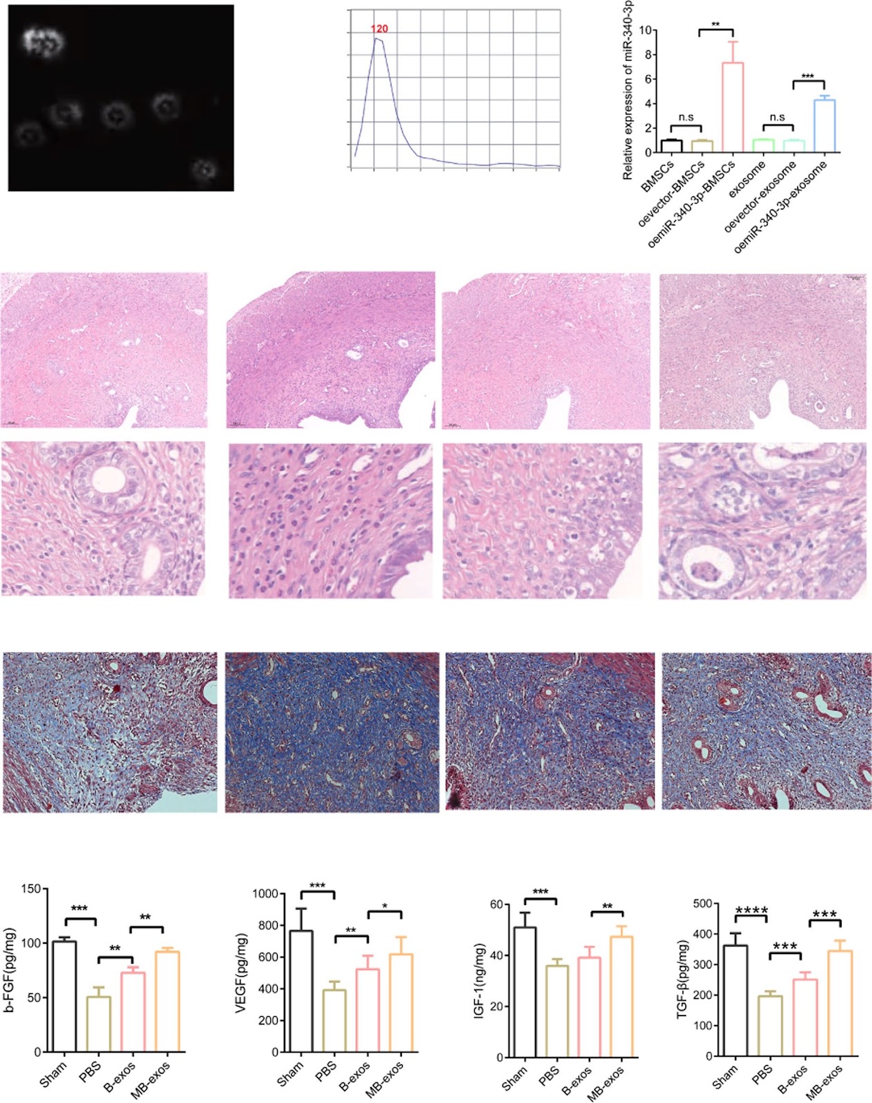 miR-340-3p-modified bone marrow mesenchymal stem cell-derived exosomes inhibit ferroptosis through METTL3-mediated m6A modification of HMOX1 to promote recovery of injured rat uterus