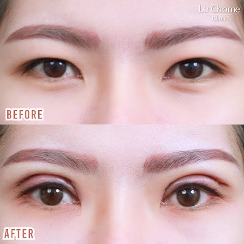 ตา 2 ชั้น