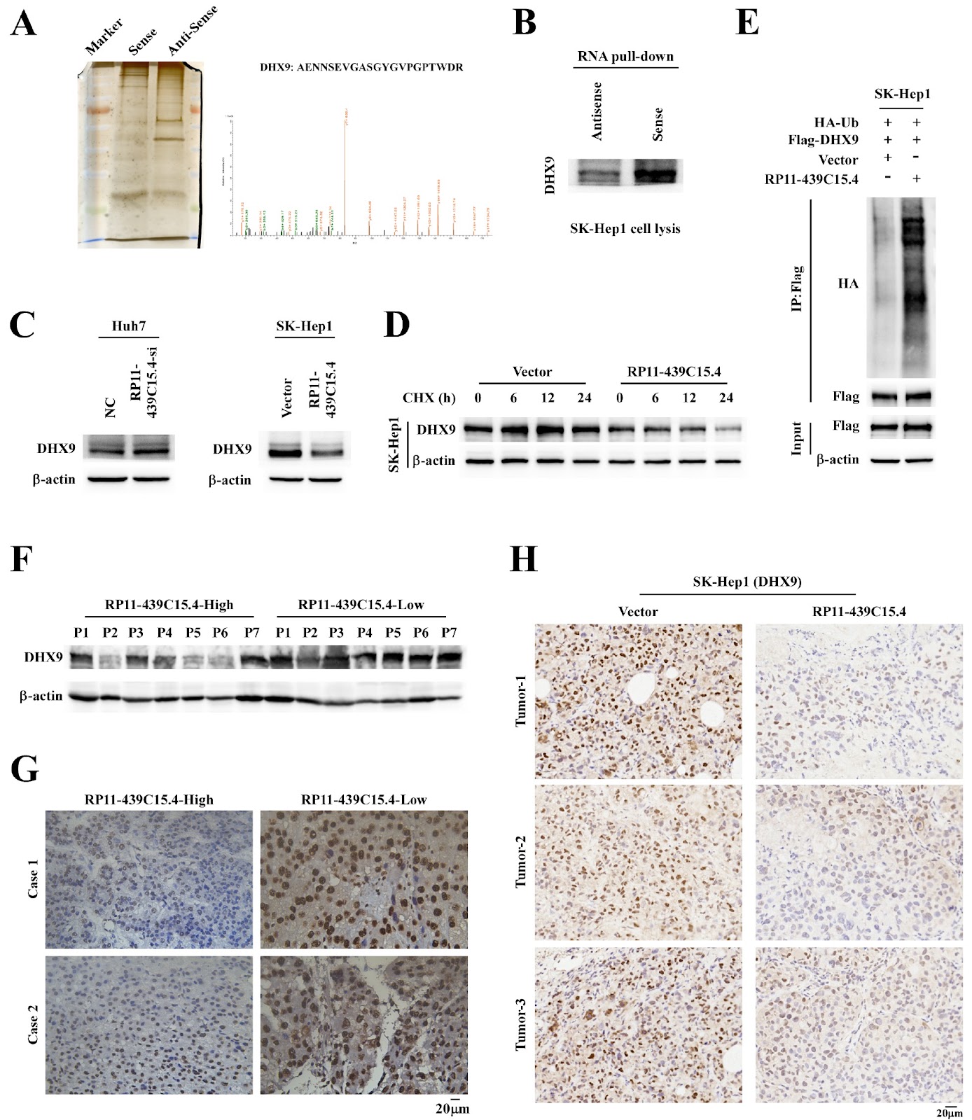 RP11-439C15.4 inhibits the malignant progression of hepatocellular carcinoma via binding to DHX9 and facilitating its degradation