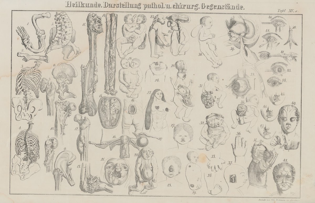 Atlas der Abbildungen Pierers Universal Lexikon Pl24 1848