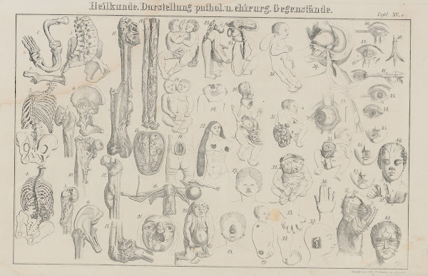 Atlas der Abbildungen Pierers Universal Lexikon Pl24 1848