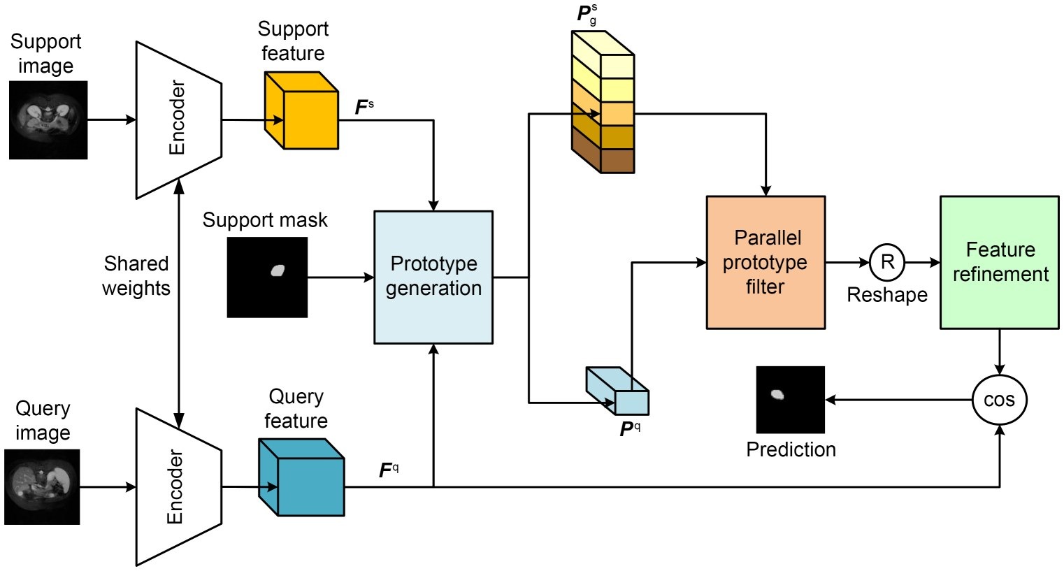 Parallel prototype filter and feature refinement for few-shot medical image segmentation