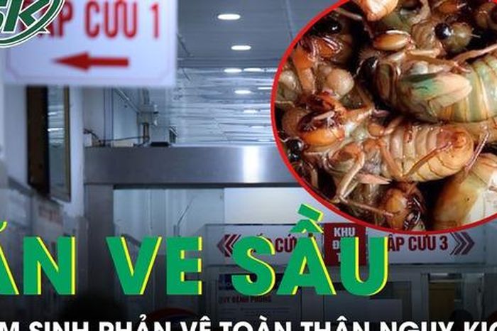 Ăn 2 con ve sầu, nam sinh 17 tuổi nhập viện lúc nửa đêm vì phản vệ toàn thân - Báo Sức Khỏe &amp; Đời Sống