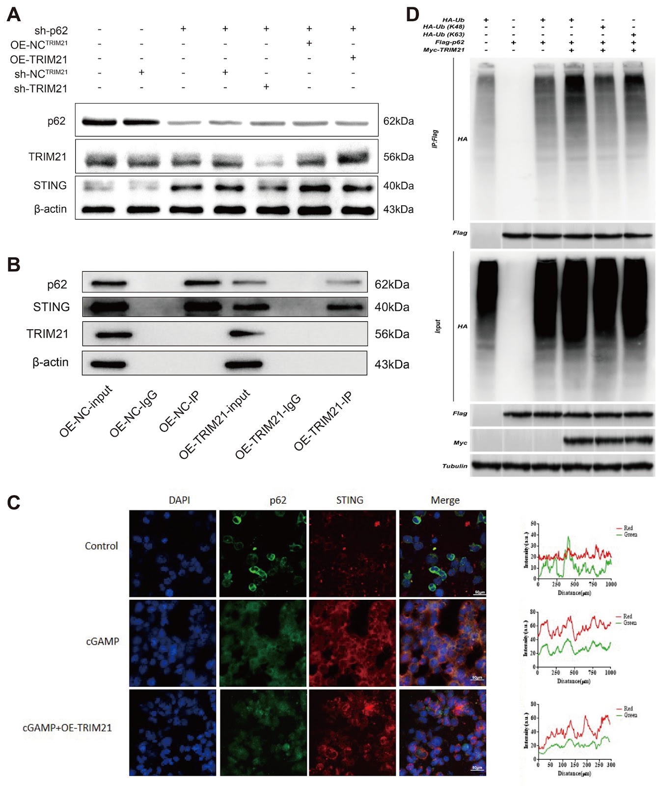 TRIM21 promotes type I interferon by inhibiting the autophagic degradation of STING via p62/SQSTM1 ubiquitination in systemic lupus erythematosus