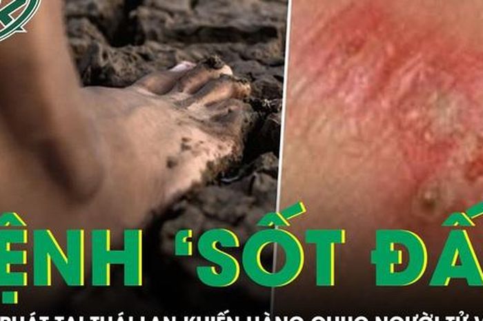 Bệnh 'sốt đất' bùng phát tại Thái Lan khiến hàng chục người tử vong - Báo Sức Khỏe &amp; Đời Sống
