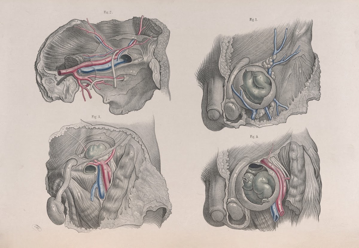 Surgical anatomy Pl37 1856