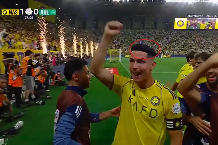 Chiếc vòng đen bí ẩn trên đầu Ronaldo - Tạp chí Tri thức