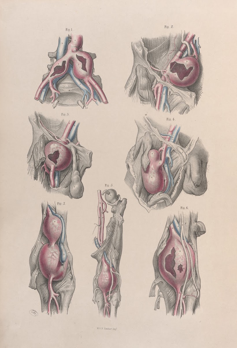 Surgical anatomy Pl52 1856