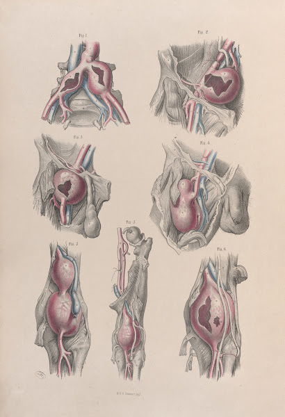 Surgical anatomy Pl52 1856